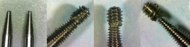 Retriever multiuso LockFit para parafuso fraturado